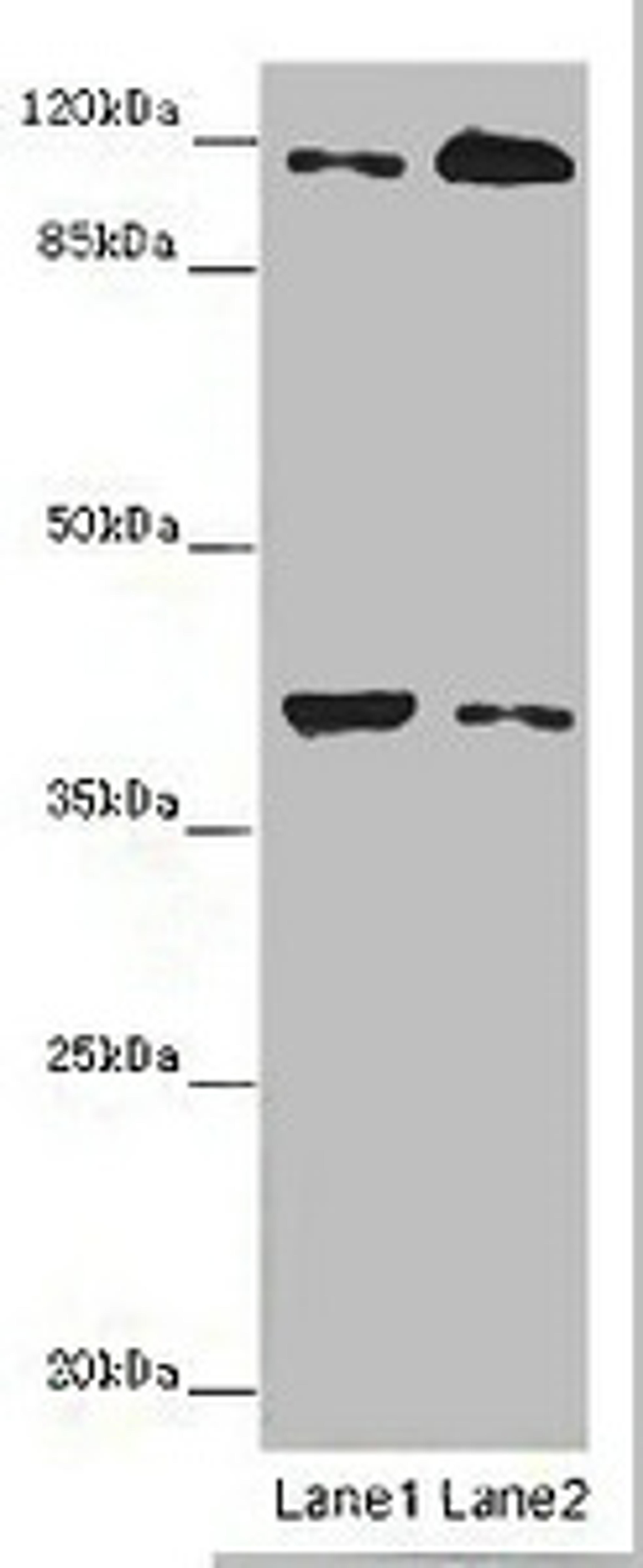 Western blot. All lanes: MILR1 antibody at 14 ug/ml. Lane 1: Mouse brain tissue. Lane 2: HepG2 whole cell lysate. Secondary. Goat polyclonal to rabbit IgG at 1/10000 dilution. Predicted band size: 39, 28, 29 kDa. Observed band size: 39, 120 kDa. 