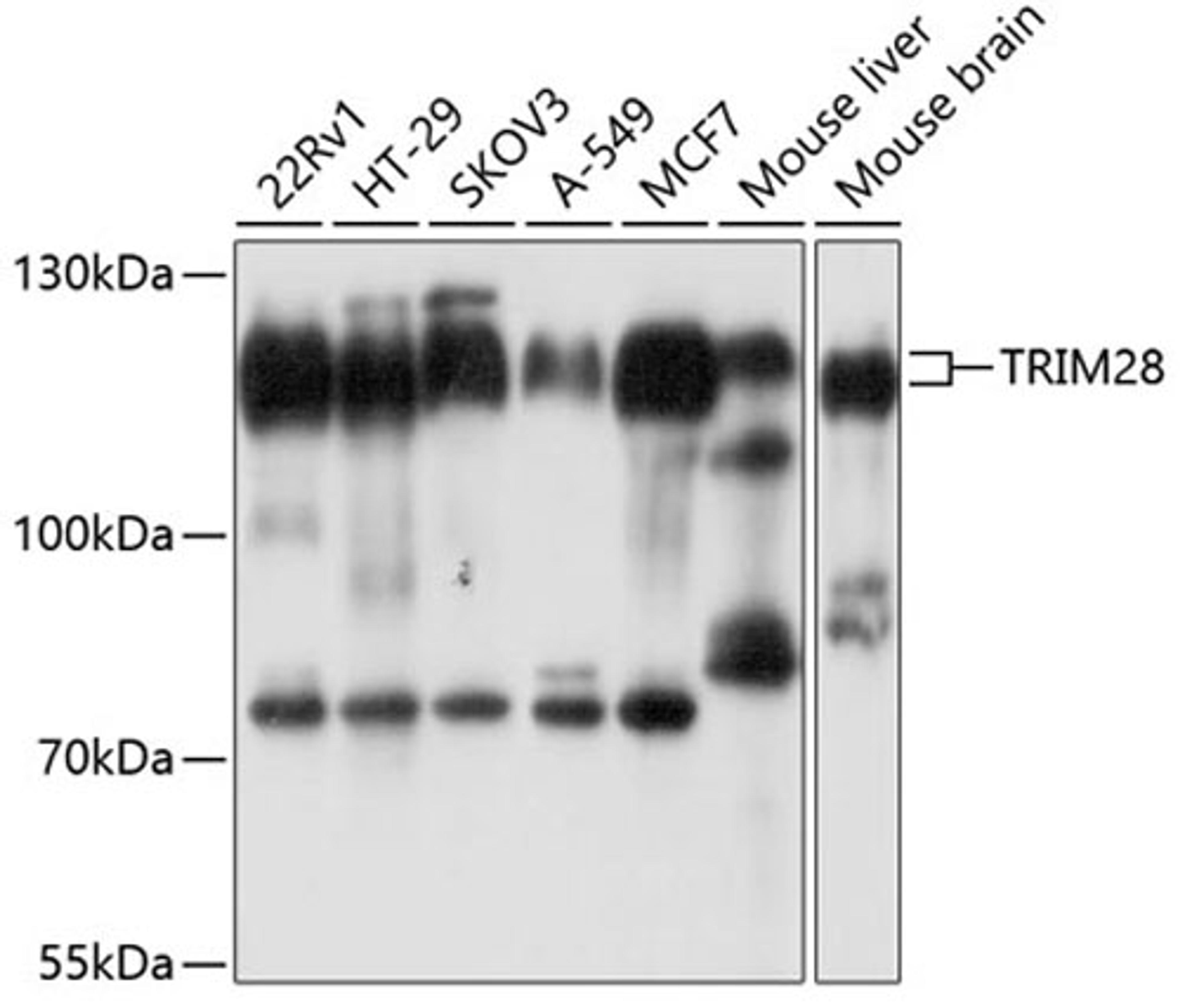 Western blot - TRIM28 antibody (A2245)