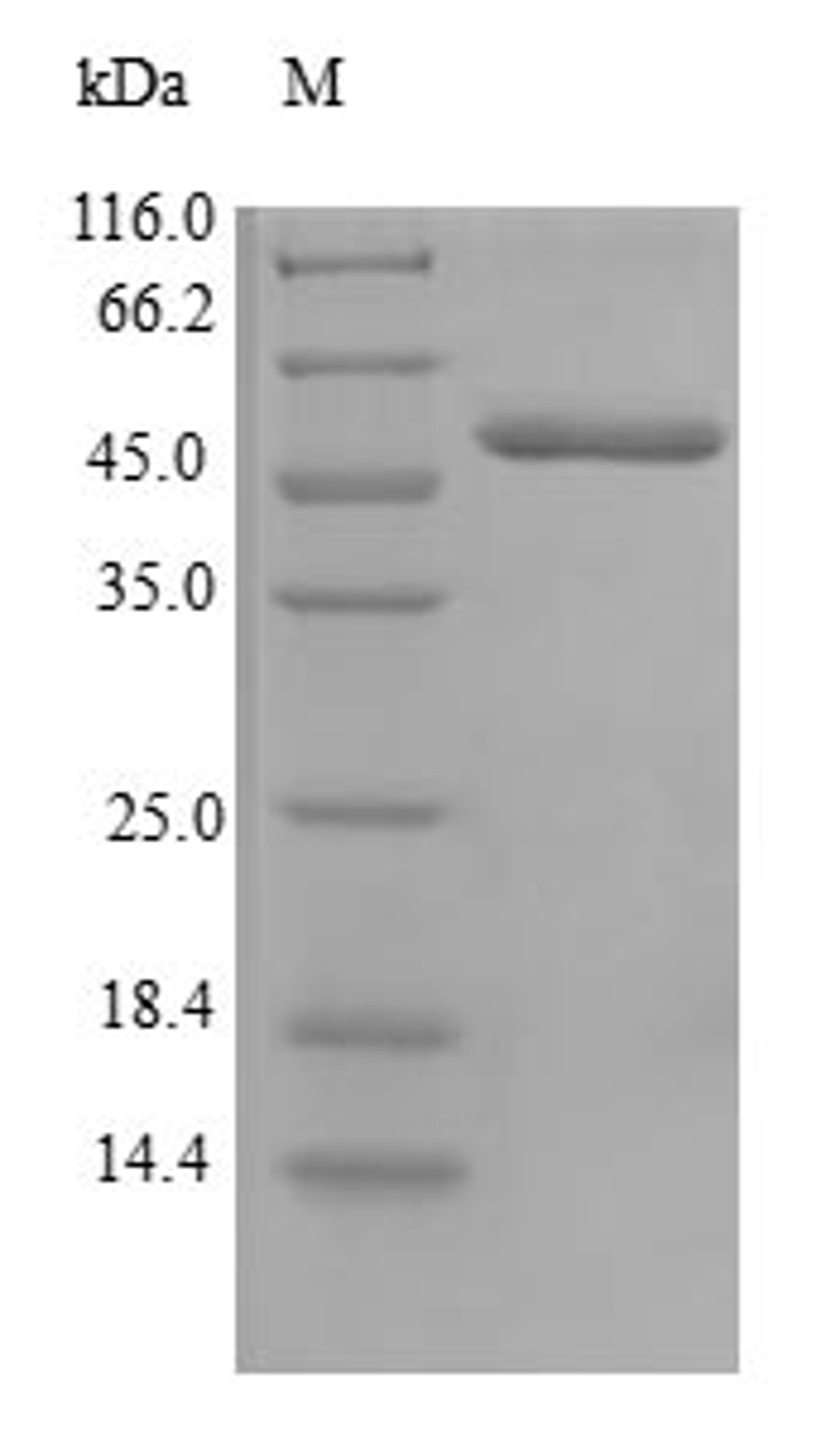 (Tris-Glycine gel) Discontinuous SDS-PAGE (reduced) with 5% enrichment gel and 15% separation gel.