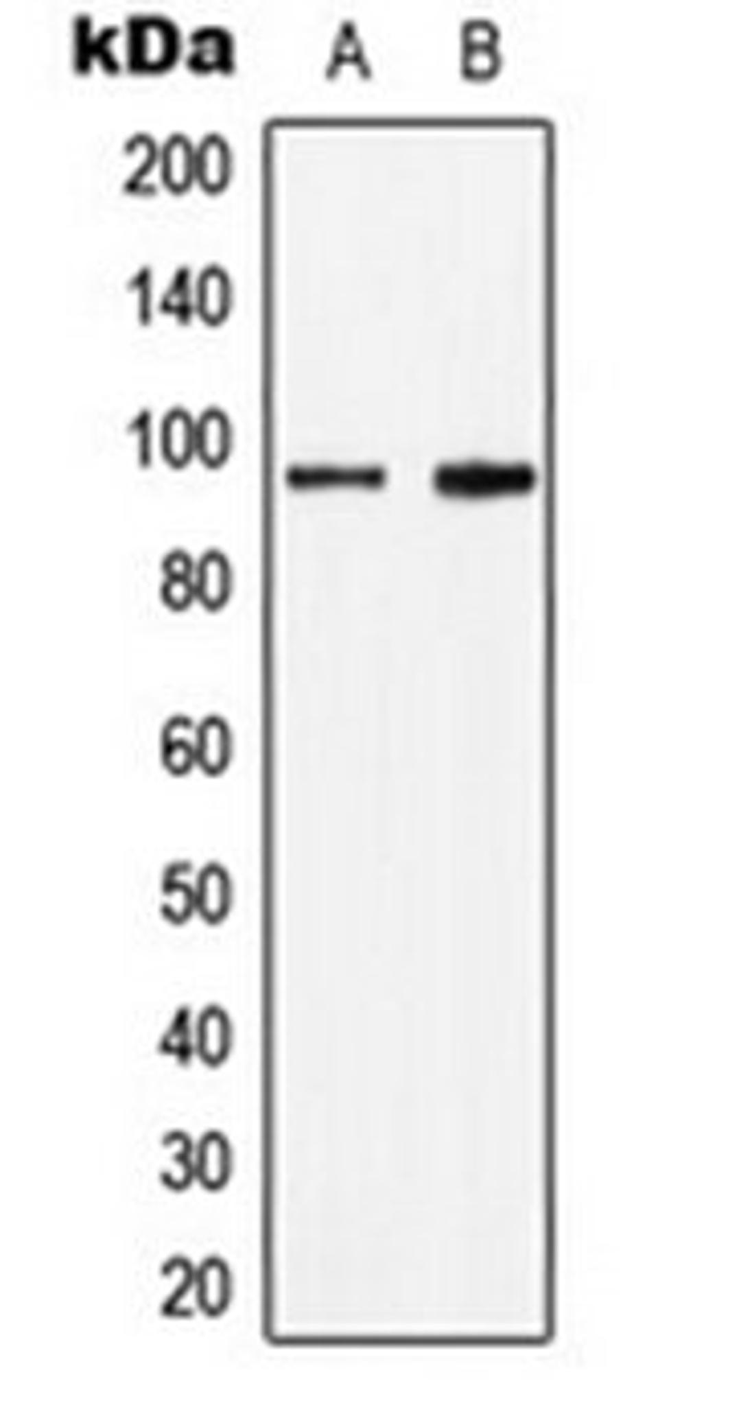 Western blot analysis of HepG2 IL4-treated (Lane 1), HeLa IL-4-treated (Lane 2) whole cell lysates using STAT6 (phospho-Y641) antibody