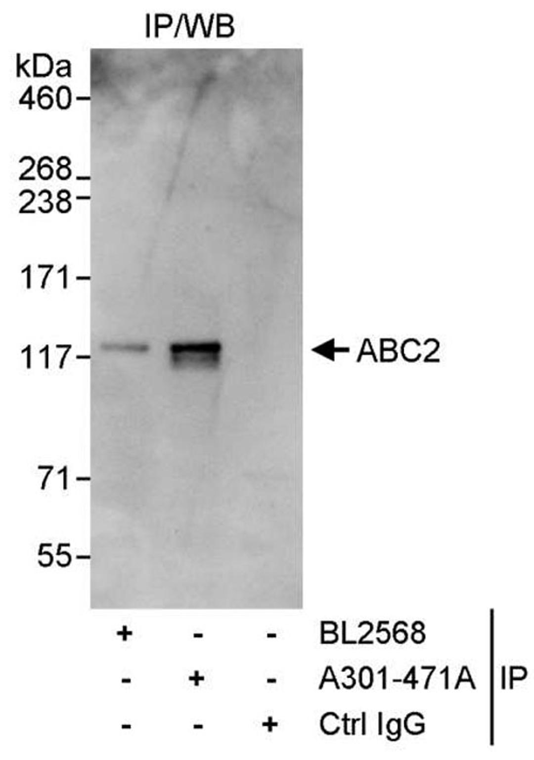 Detection of human ABC2 by WB of IP.