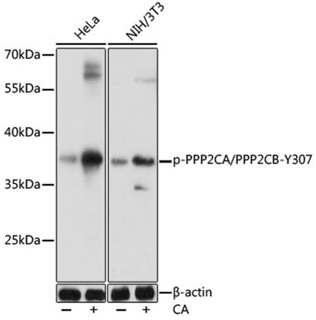 Western blot - Phospho-PPP2CA/PPP2CB-Y307 antibody (AP0927)