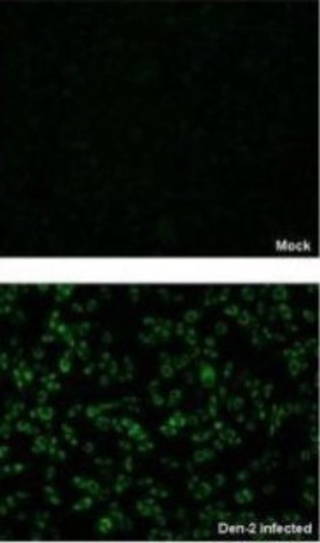 Immunocytochemistry/Immunofluorescence: NS4B Antibody [NBP2-42898] - Analysis of paraformaldehyde-fixed BHK-21 cell, using NS4B (Dengue virus 2) antibody at 1:2000 dilution..