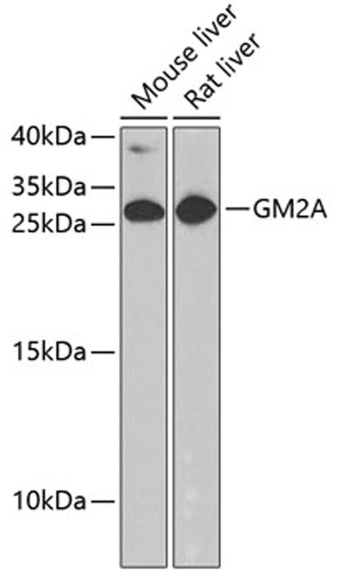 Western blot - GM2A antibody (A6605)