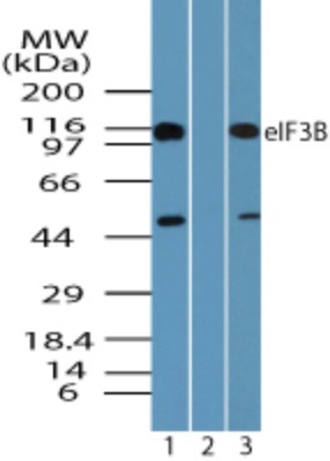 Western Blot: EIF3B Antibody [NBP2-24571] - analysis of eIF3B in A431 cell lysate in the 1) absence and 2) presence of immunizing peptide and 3) NIH 3T3 cell lysate using eIF3B antibody at 0.25 ug/ml, 0.25 ug/ml and 0.05 ug/ml respectively.