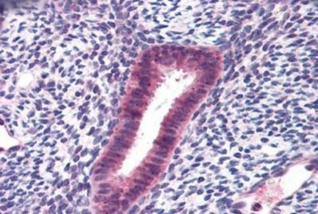 Immunohistochemistry-Paraffin: FOXN1 Antibody [NBP1-72022] - Staining of human uterus. Immunohistochemistry of formalin-fixed, paraffin-embedded tissue after heat-induced antigen retrieval. Antibody concentration 10 ug/ml.