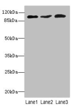 Western blot. All lanes: DDX20antibody at 2.05ug/ml. Lane 1: 293T whole cell lysate. Lane 2: HepG2 whole cell lysate. Lane 3: Hela whole cell lysate. Secondary. Goat polyclonal to rabbit IgG at 1/10000 dilution. Predicted band size: 93, 15 kDa. Observed band size: 93 kDa. 