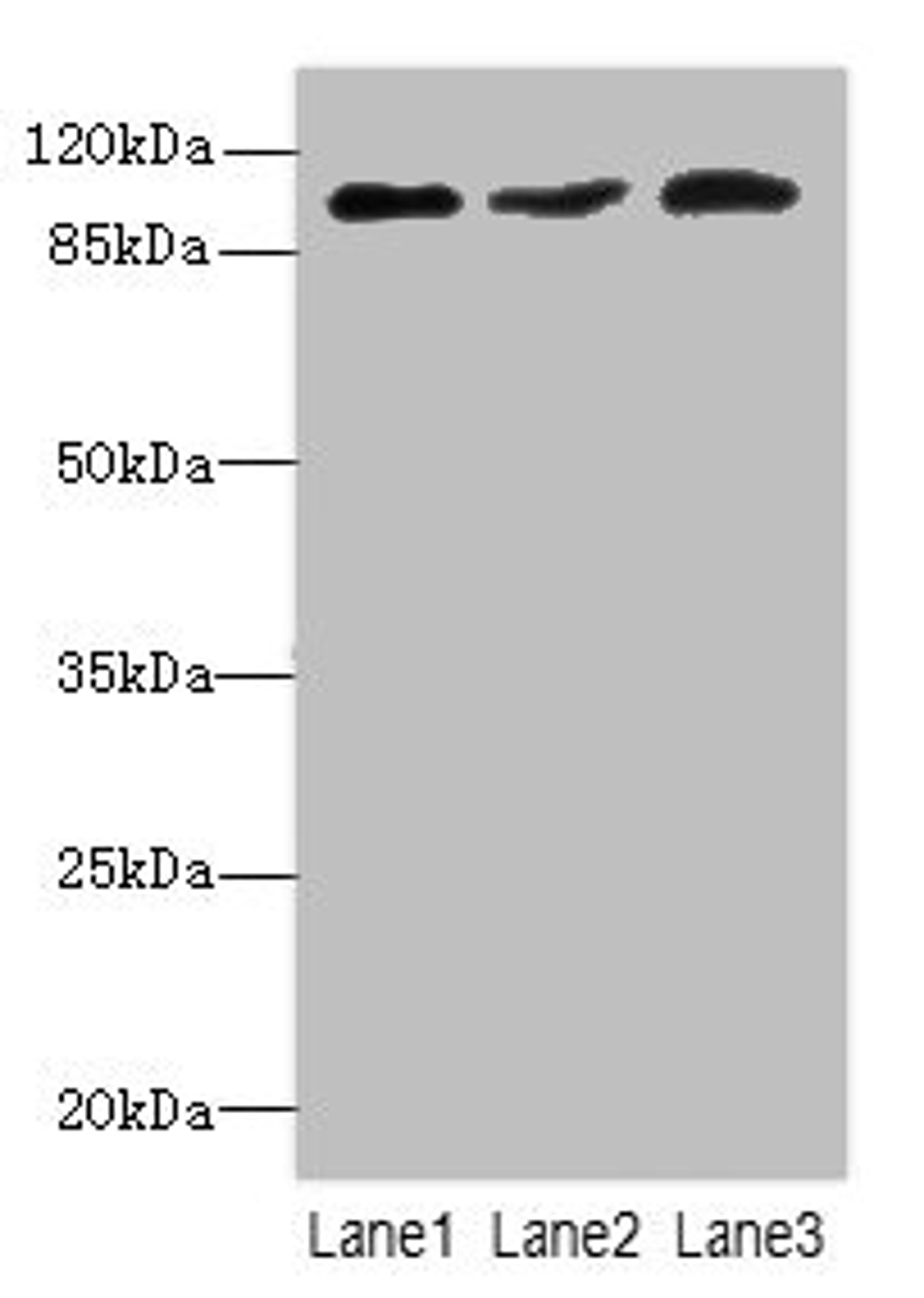 Western blot. All lanes: DDX20antibody at 2.05ug/ml. Lane 1: 293T whole cell lysate. Lane 2: HepG2 whole cell lysate. Lane 3: Hela whole cell lysate. Secondary. Goat polyclonal to rabbit IgG at 1/10000 dilution. Predicted band size: 93, 15 kDa. Observed band size: 93 kDa. 