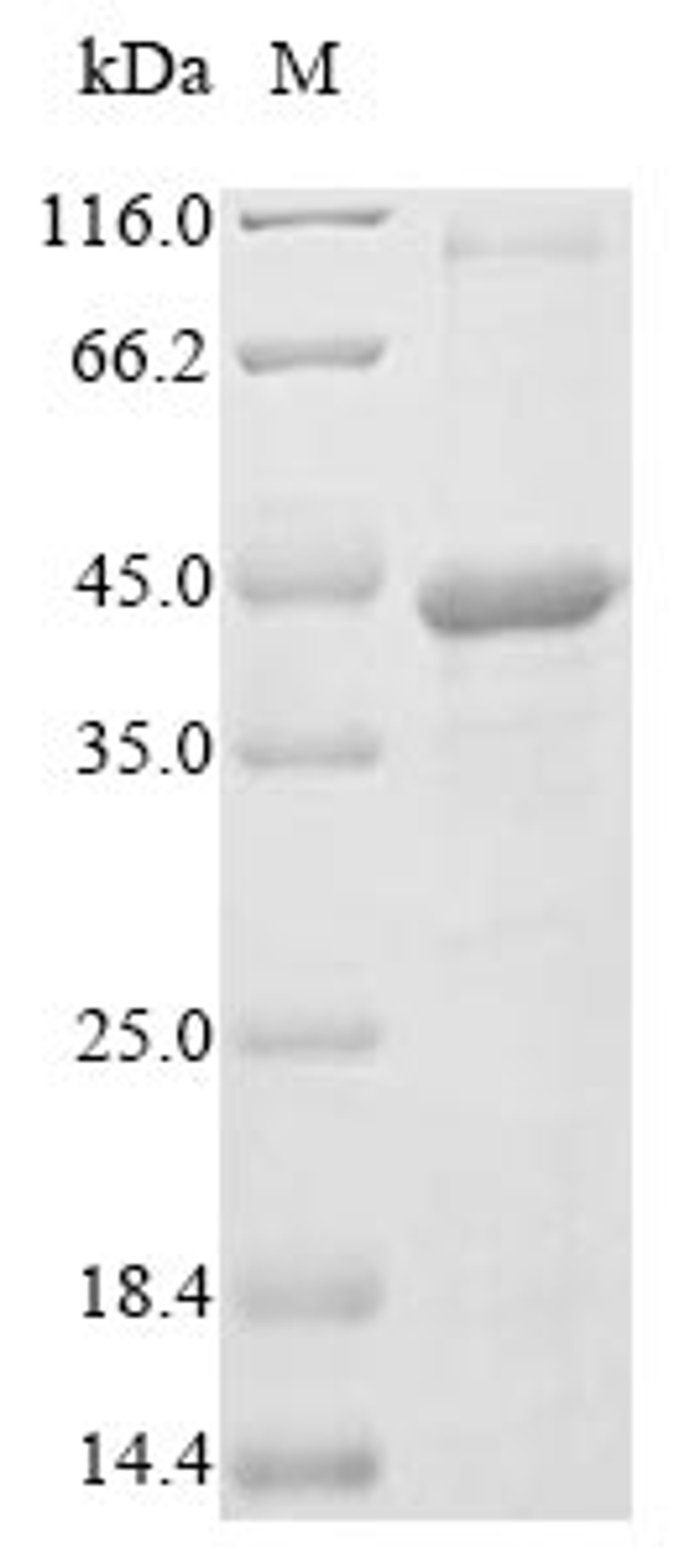 (Tris-Glycine gel) Discontinuous SDS-PAGE (reduced) with 5% enrichment gel and 15% separation gel.