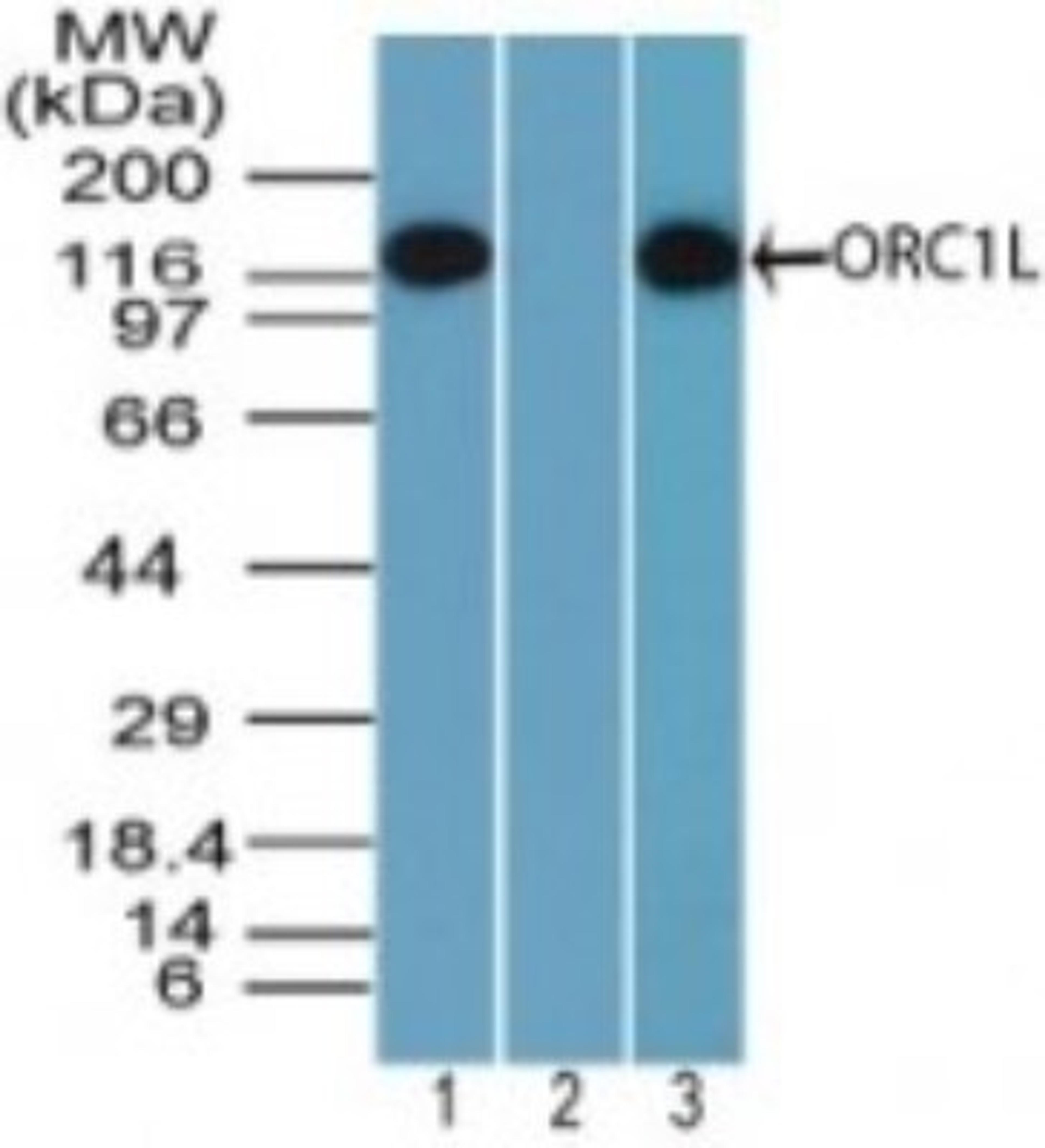 Western Blot: ORC1 Antibody [NBP2-24600] - Analysis of ORC1L in Daudi cell lysate in the 1) absence and 2) presence of immunizing peptide and in 3) NIH 3T3 cell lysate using NBP2-24600. Goat anti-rabbit Ig HRP secondary antibody and PicoTect ECL substrate solution were used for this test.