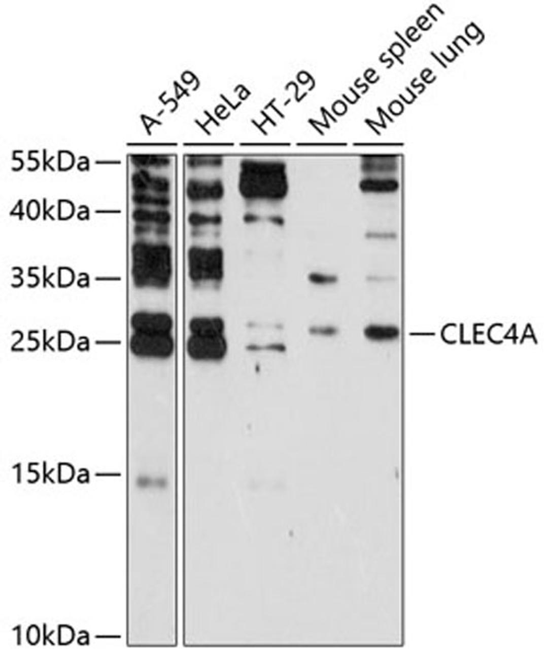 Western blot - CLEC4A antibody (A2713)