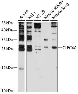 Western blot - CLEC4A antibody (A2713)