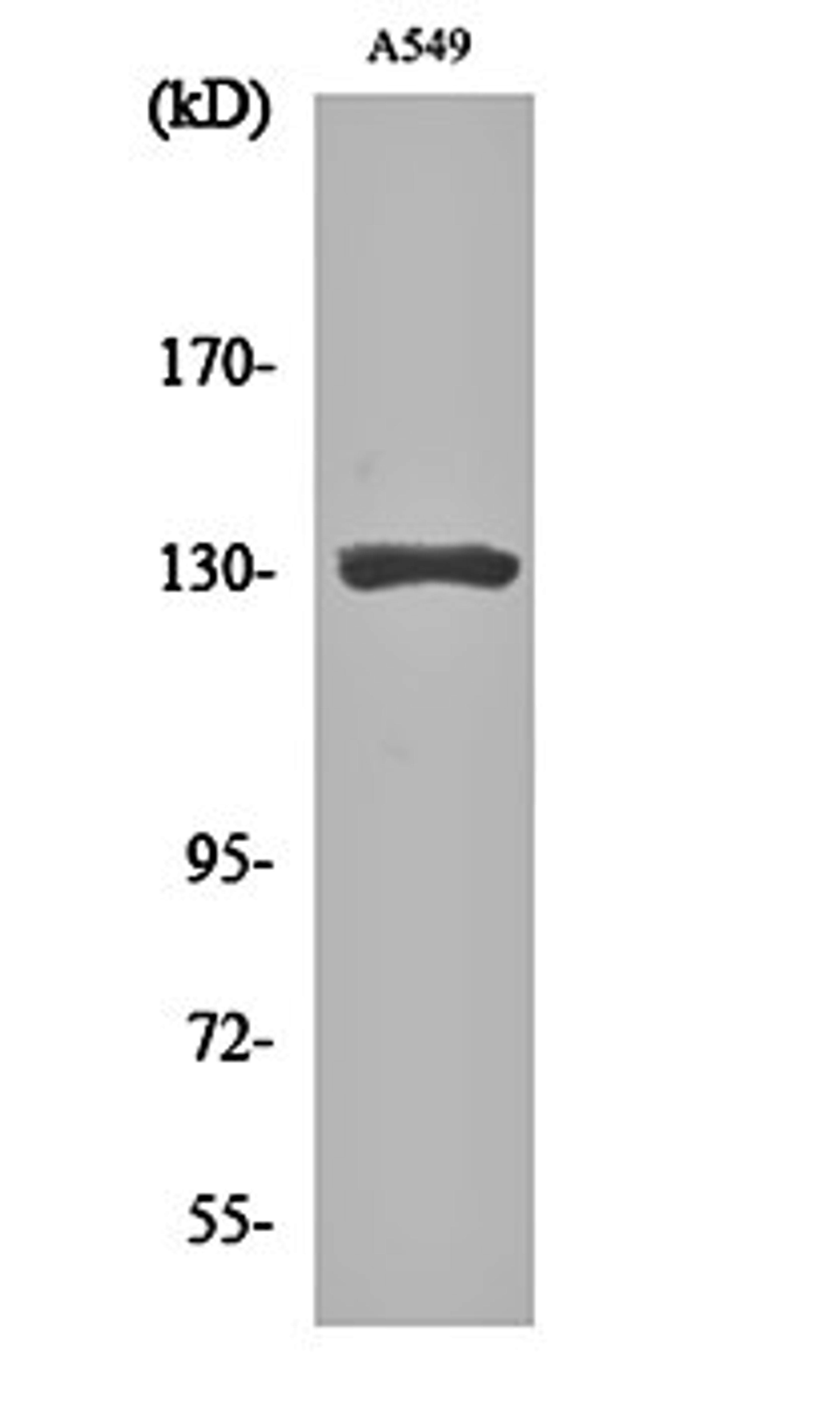 Western blot analysis of A549 cell lysates using CRSP130 antibody