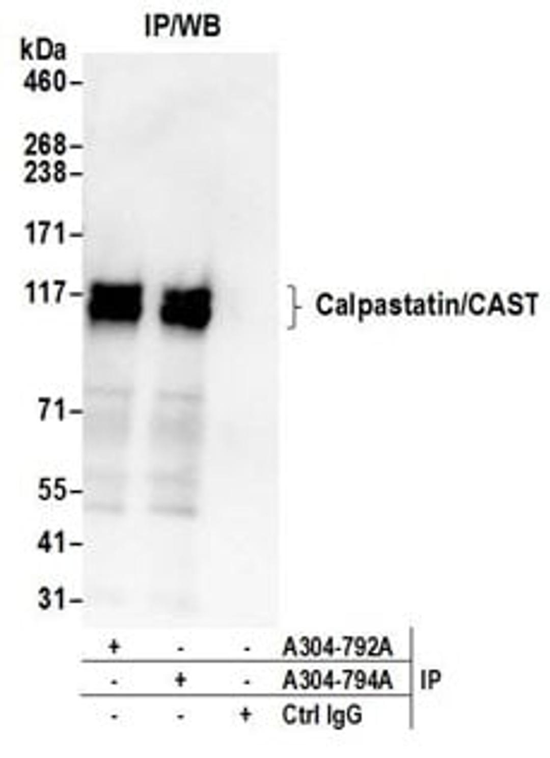 Detection of human Calpastatin/CAST by western blot of immunoprecipitates.