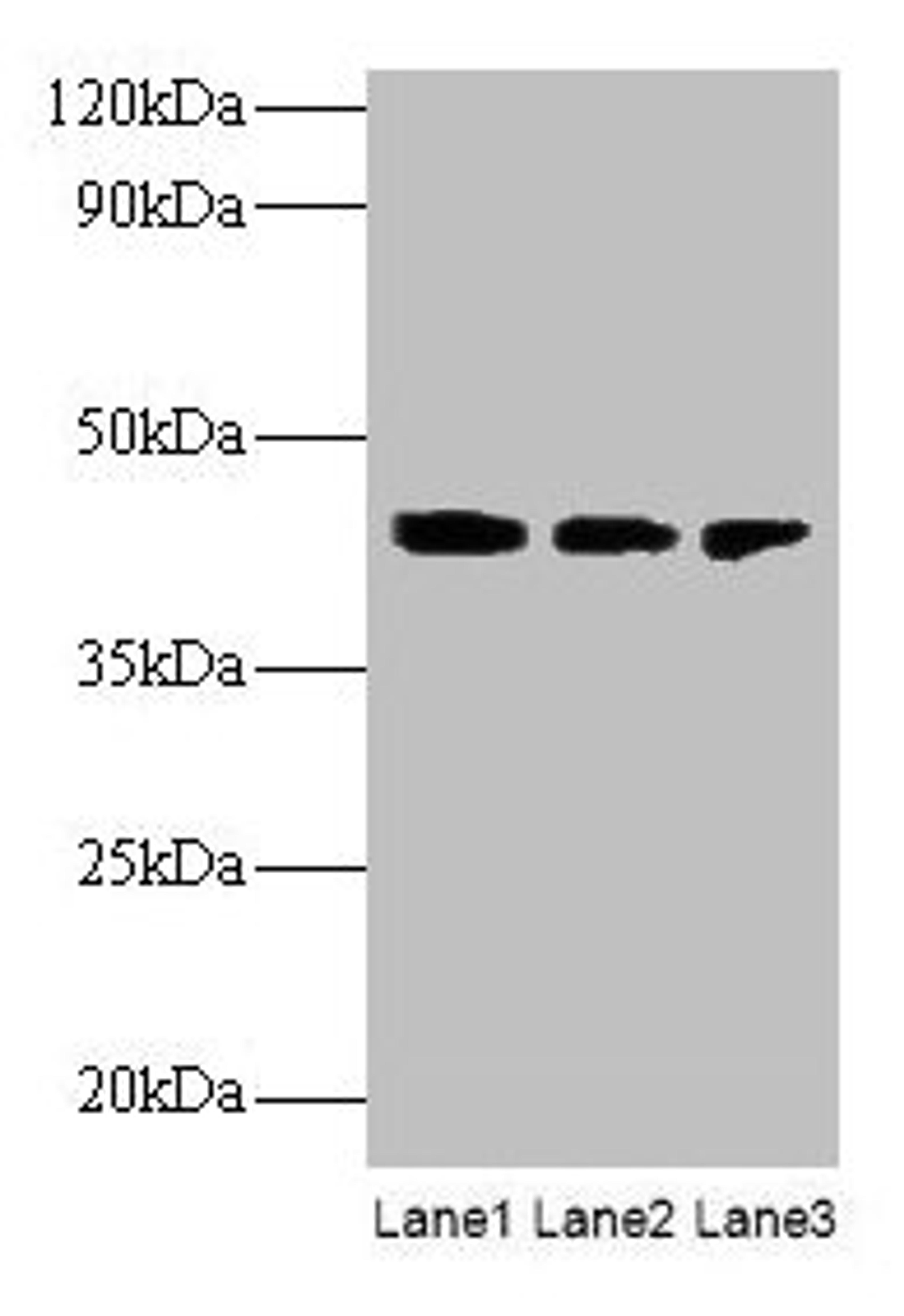 Western blot. All lanes: ILKAP antibody at 2µg/ml. Lane 1: Rat kidney tissue. Lane 2: U251 whole cell lysate. Lane 3: Mouse stomach tissue. Secondary. Goat polyclonal to rabbit IgG at 1/10000 dilution. Predicted band size: 43 kDa. Observed band size: 43 kDa