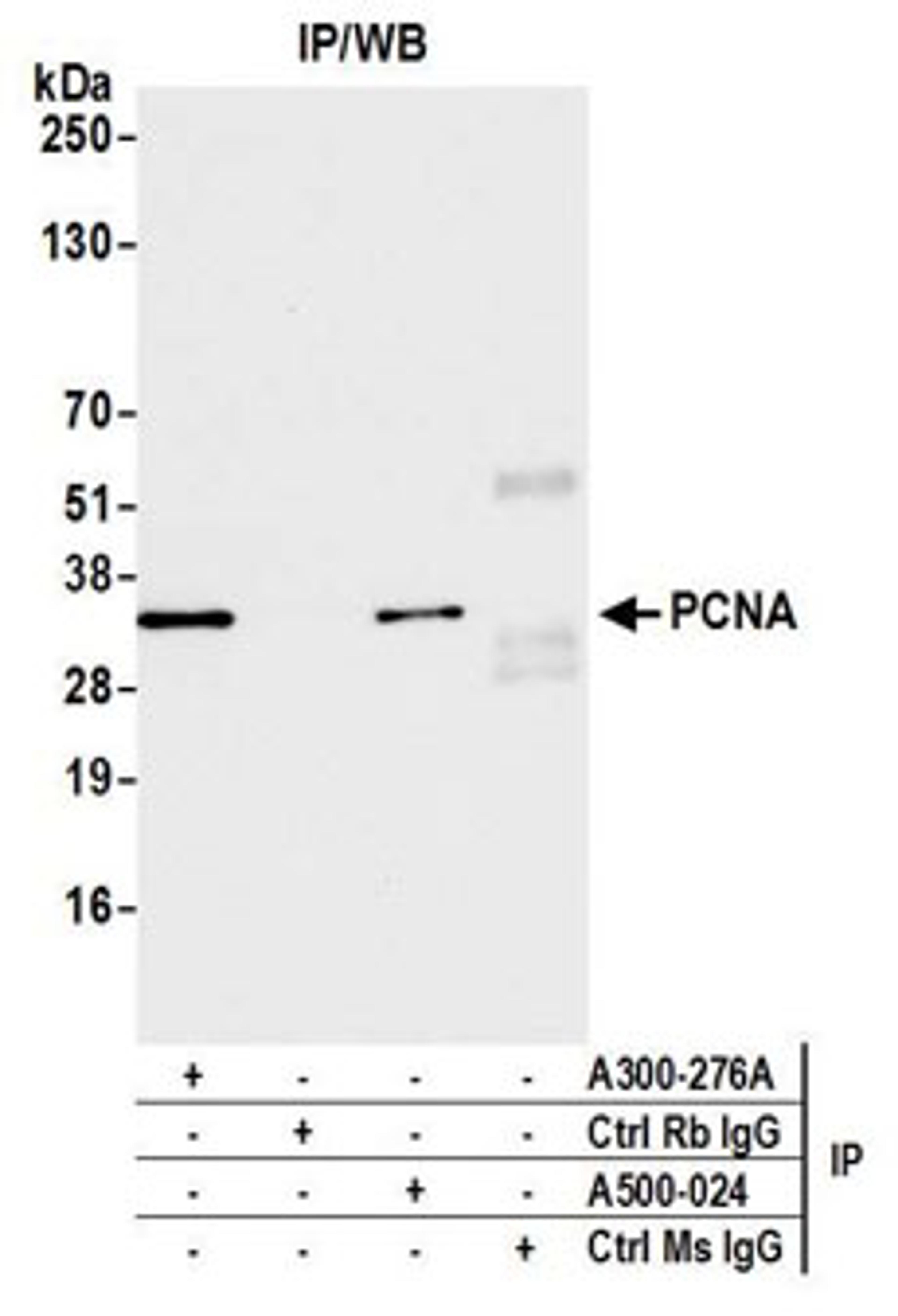 Detection of mouse PCNA by western blot of immunoprecipitates.