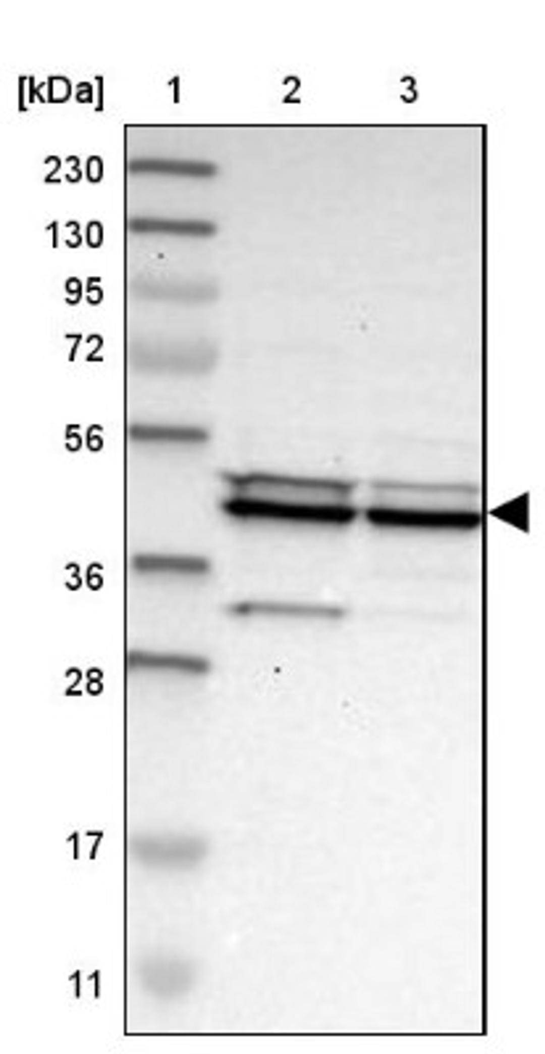 Western Blot: CCDC104 Antibody [NBP1-93513] - Lane 1: Marker [kDa] 230, 130, 95, 72, 56, 36, 28, 17, 11<br/>Lane 2: Human cell line RT-4<br/>Lane 3: Human cell line U-251MG sp