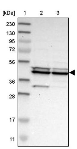 Western Blot: CCDC104 Antibody [NBP1-93513] - Lane 1: Marker [kDa] 230, 130, 95, 72, 56, 36, 28, 17, 11<br/>Lane 2: Human cell line RT-4<br/>Lane 3: Human cell line U-251MG sp