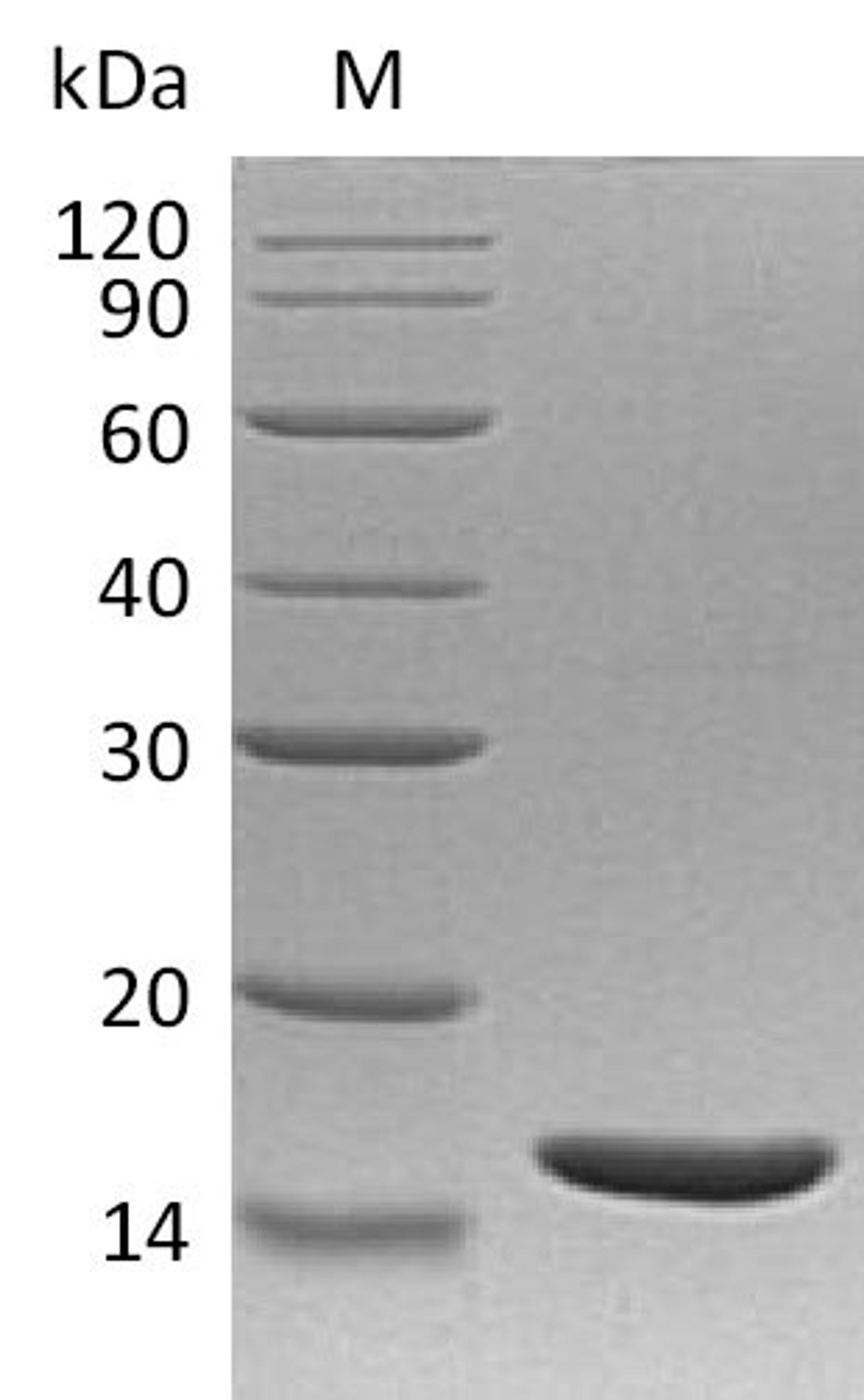 (Tris-Glycine gel) Discontinuous SDS-PAGE (reduced) with 5% enrichment gel and 15% separation gel.