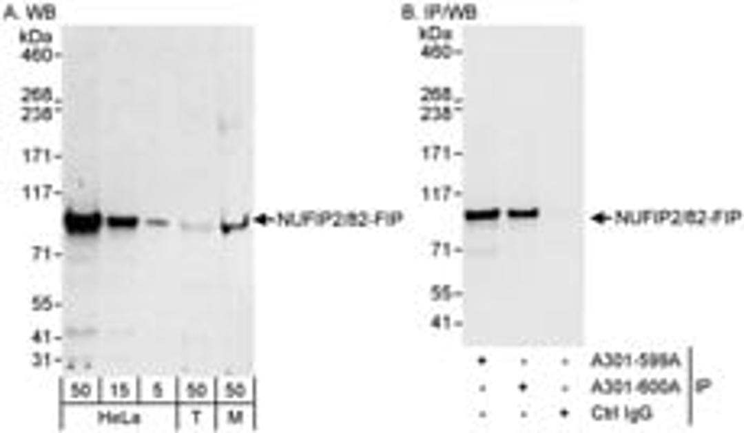 Detection of human and mouse NUFIP2/82-FIP by western blot (h&m) and immunoprecipitation (h).