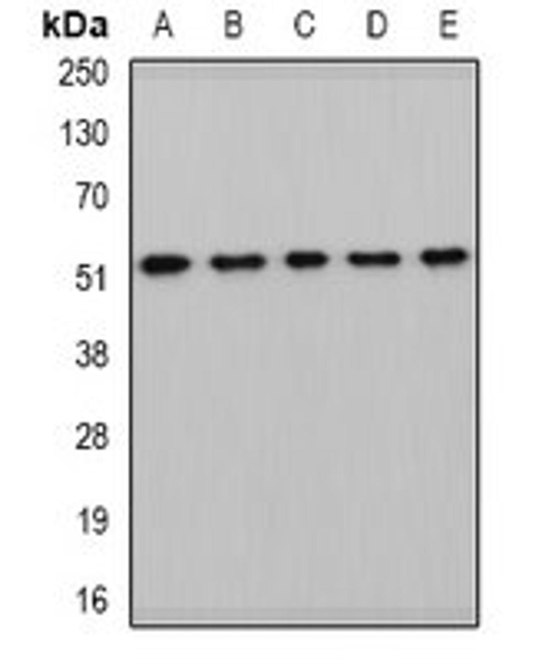 Western blot analysis of HepG2 (Lane1), mouse kidney (Lane2), mouse heart (Lane3), rat liver (Lane4), rat brain (Lane5) whole cell lysates using HARS2 antibody