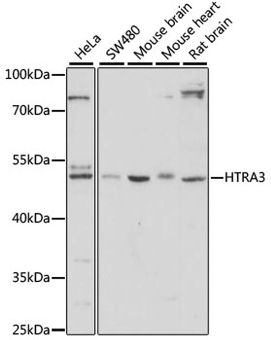 Western blot - HTRA3 antibody (A14649)