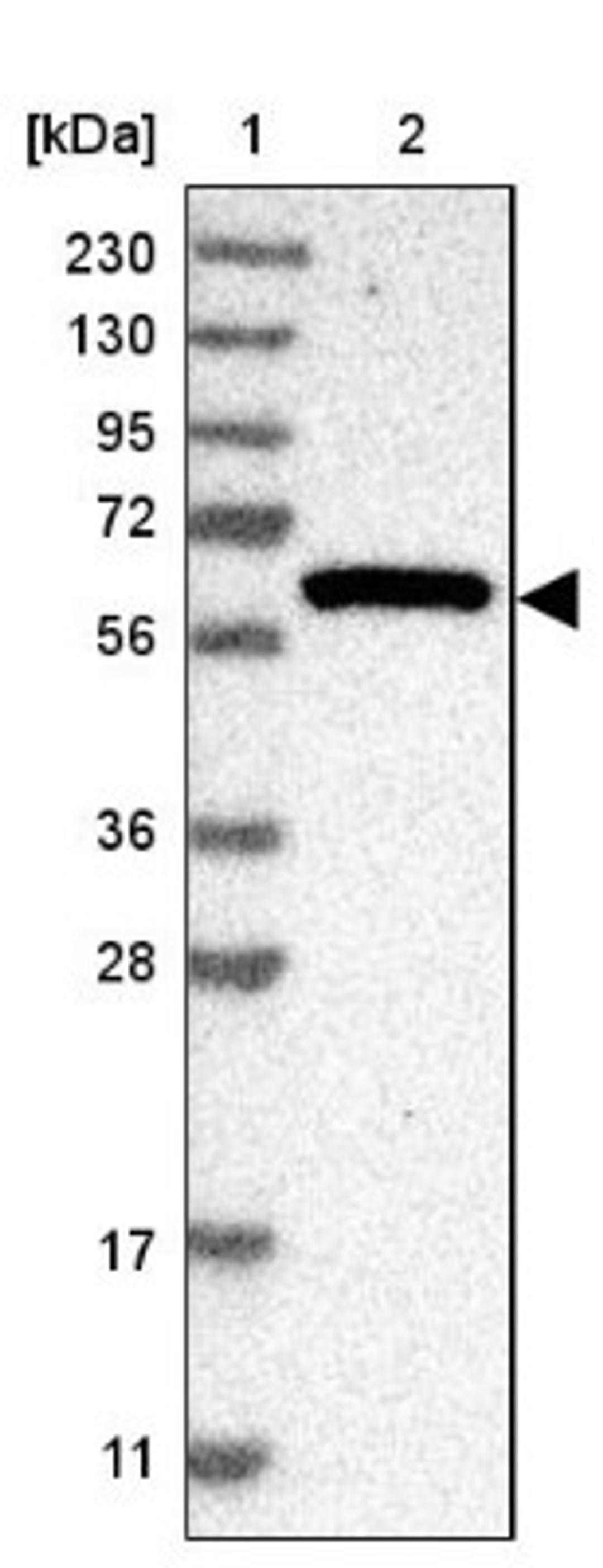 Western Blot: Tryptophan Hydroxylase 1 Antibody [NBP1-86922] - Lane 1: Marker [kDa] 230, 130, 95, 72, 56, 36, 28, 17, 11<br/>Lane 2: Human cell line RT-4