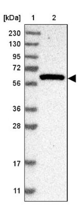 Western Blot: Tryptophan Hydroxylase 1 Antibody [NBP1-86922] - Lane 1: Marker [kDa] 230, 130, 95, 72, 56, 36, 28, 17, 11<br/>Lane 2: Human cell line RT-4