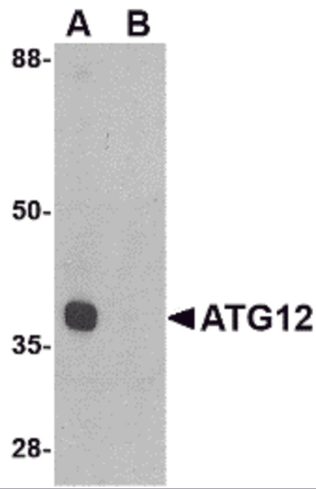 Western blot analysis of ATG12 in mouse heart tissue lysate with ATG12 antibody at 1 μg/mL in (A) the absence and (B) the presence of blocking peptide.