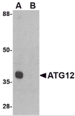 Western blot analysis of ATG12 in mouse heart tissue lysate with ATG12 antibody at 1 μg/mL in (A) the absence and (B) the presence of blocking peptide.