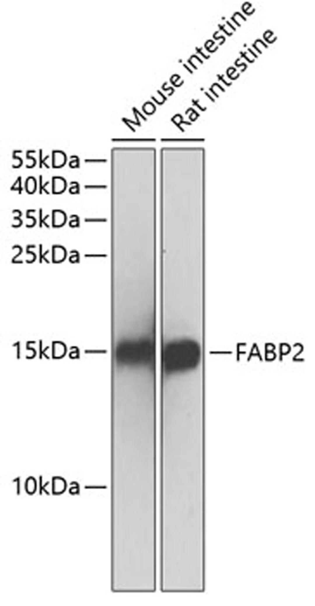 Western blot - FABP2 antibody (A1621)