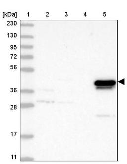 Western Blot: alcohol dehydrogenase 4 Antibody [NBP1-90233] - Lane 1: Marker [kDa] 230, 130, 95, 72, 56, 36, 28, 17, 11<br/>Lane 2: Human cell line RT-4<br/>Lane 3: Human cell line U-251MG sp<br/>Lane 4: Human plasma (IgG/HSA depleted)<br/>Lane 5: Human liver tissue