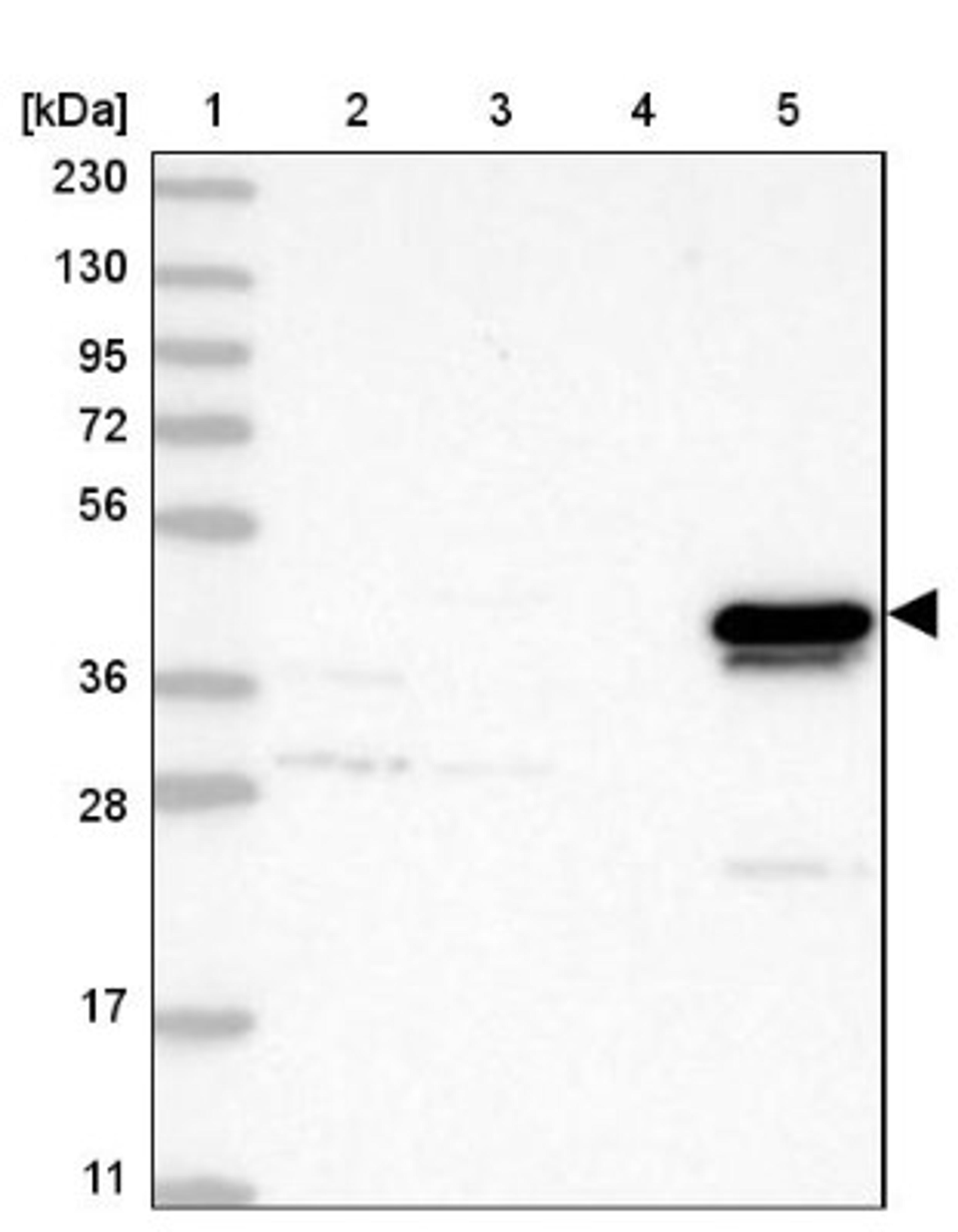 Western Blot: alcohol dehydrogenase 4 Antibody [NBP1-90233] - Lane 1: Marker [kDa] 230, 130, 95, 72, 56, 36, 28, 17, 11<br/>Lane 2: Human cell line RT-4<br/>Lane 3: Human cell line U-251MG sp<br/>Lane 4: Human plasma (IgG/HSA depleted)<br/>Lane 5: Human liver tissue