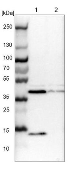 Western Blot: ACADS Antibody [NBP1-89290] - Lane 1: NIH-3T3 cell lysate (Mouse embryonic fibroblast cells)<br/>Lane 2: NBT-II cell lysate (Rat Wistar bladder tumour cells)