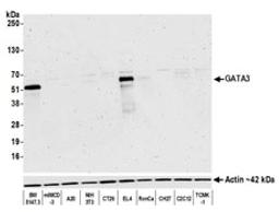 Detection of mouse GATA3 by western blot.