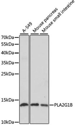 Western blot - PLA2G1B antibody (A5478)