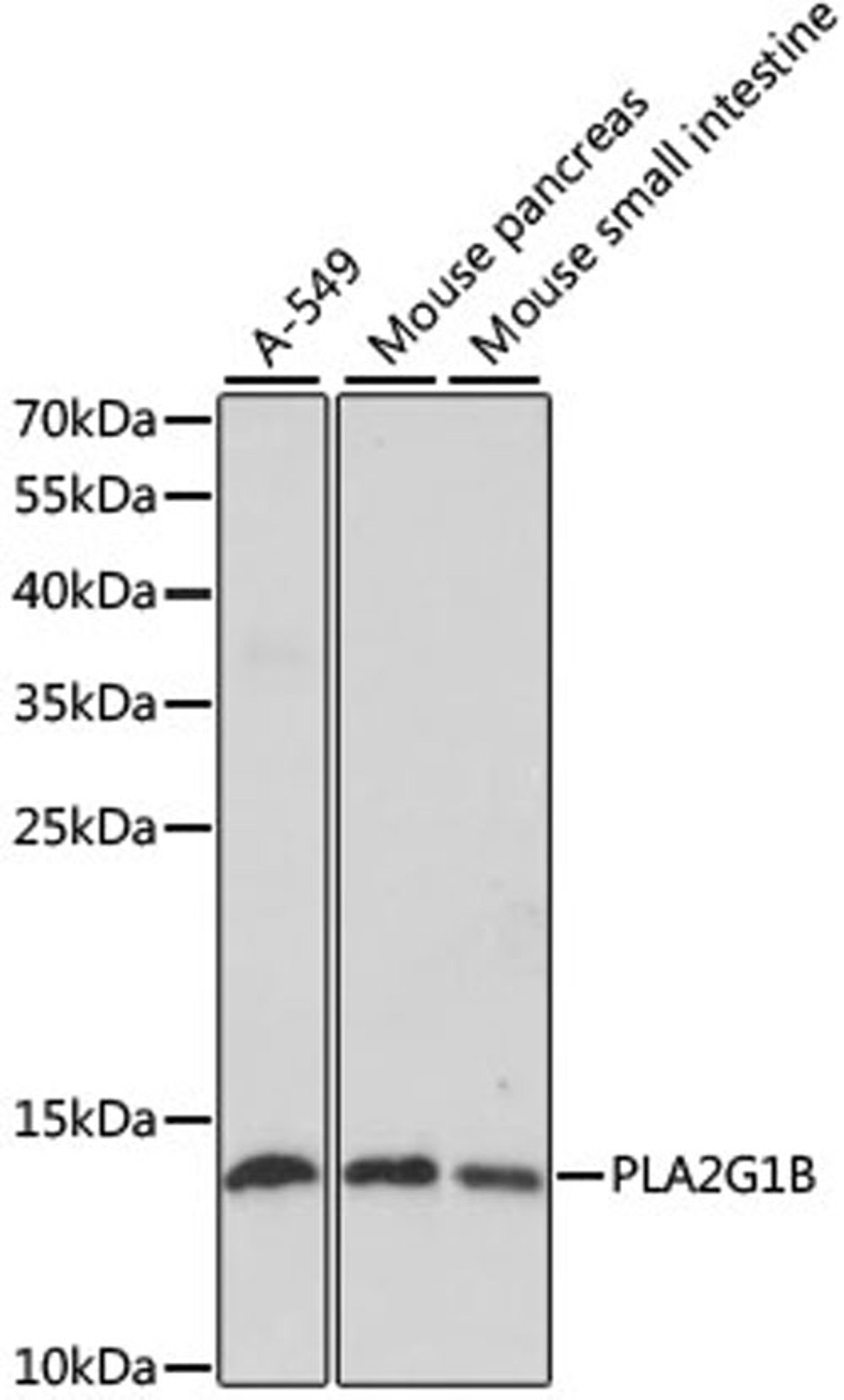 Western blot - PLA2G1B antibody (A5478)