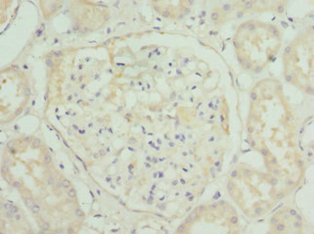 Immunohistochemistry of paraffin-embedded human kidney tissue using CSB-PA842354ESR1HU at dilution of 1:100
