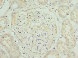 Immunohistochemistry of paraffin-embedded human kidney tissue using CSB-PA842354ESR1HU at dilution of 1:100