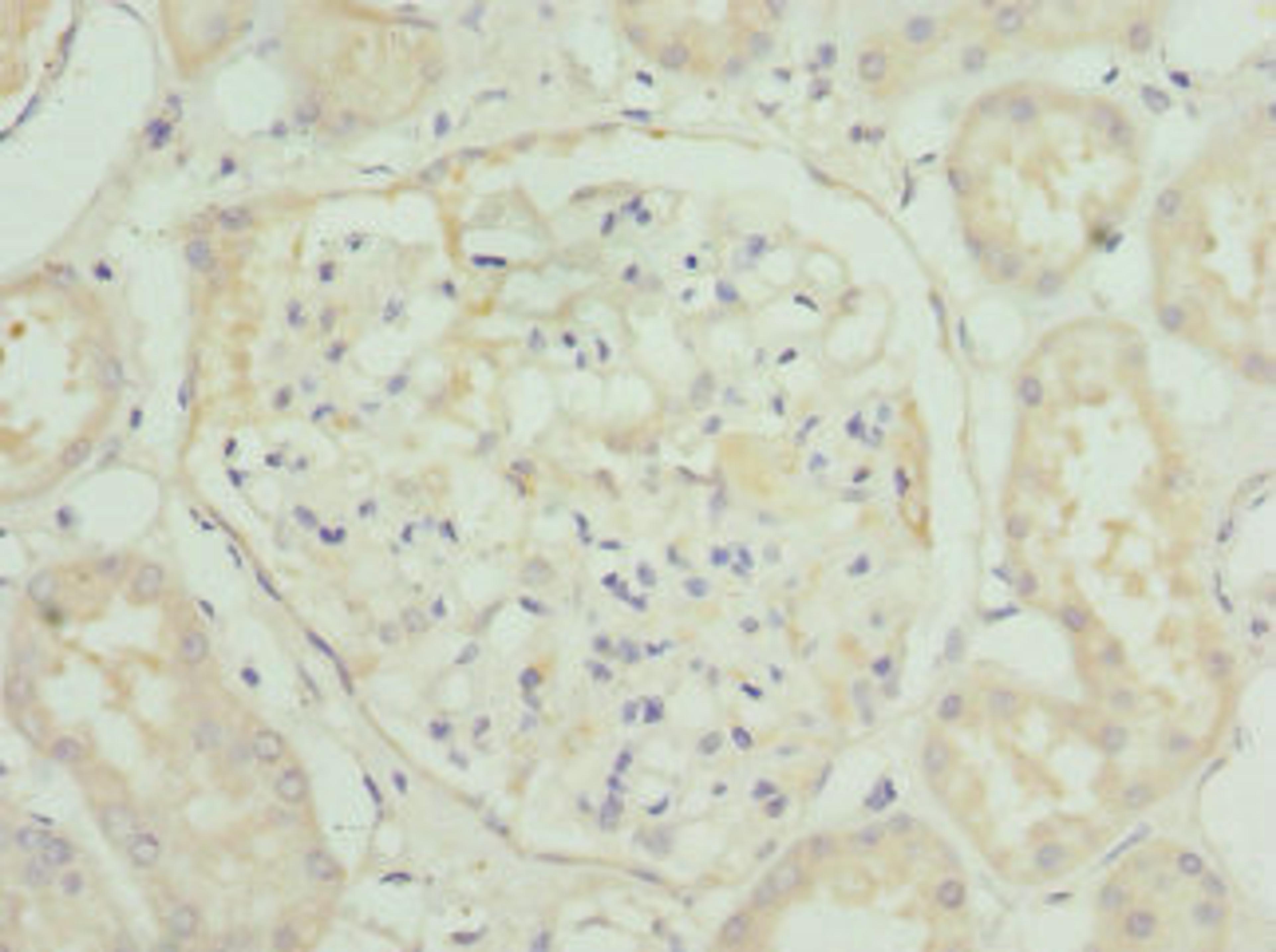 Immunohistochemistry of paraffin-embedded human kidney tissue using CSB-PA842354ESR1HU at dilution of 1:100