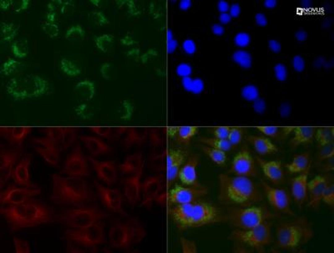 Immunocytochemistry/Immunofluorescence: LC3B/MAP1LC3B Antibody (1251A) [NBP2-46892] - HeLa cells were treated with 50 uM Chloroquine for 24 hour prior to fixation in 10% buffered formalin for 10 min. Cells were permeabilized in 0.1% Triton X-100 and incubated with 20 ug/ml anti-LC3B (1251A) and 1:500 anti-tubulin NB100-690) for 1 h at room temperature. LC3 reactivity (green) was detected with ant-rabbit Dylight 488 and tubulin (red) with anti-mouse Dylight 550. Nuclei were counterstained with DAPI (blue).