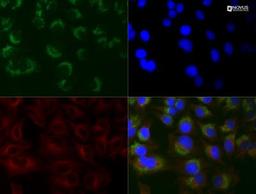 Immunocytochemistry/Immunofluorescence: LC3B/MAP1LC3B Antibody (1251A) [NBP2-46892] - HeLa cells were treated with 50 uM Chloroquine for 24 hour prior to fixation in 10% buffered formalin for 10 min. Cells were permeabilized in 0.1% Triton X-100 and incubated with 20 ug/ml anti-LC3B (1251A) and 1:500 anti-tubulin NB100-690) for 1 h at room temperature. LC3 reactivity (green) was detected with ant-rabbit Dylight 488 and tubulin (red) with anti-mouse Dylight 550. Nuclei were counterstained with DAPI (blue).