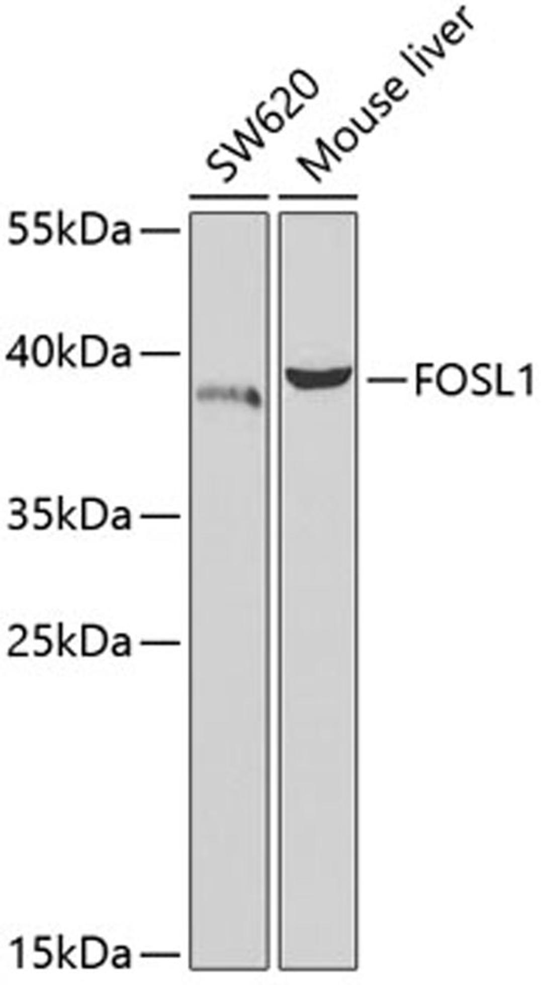 Western blot - FOSL1 antibody (A5372)