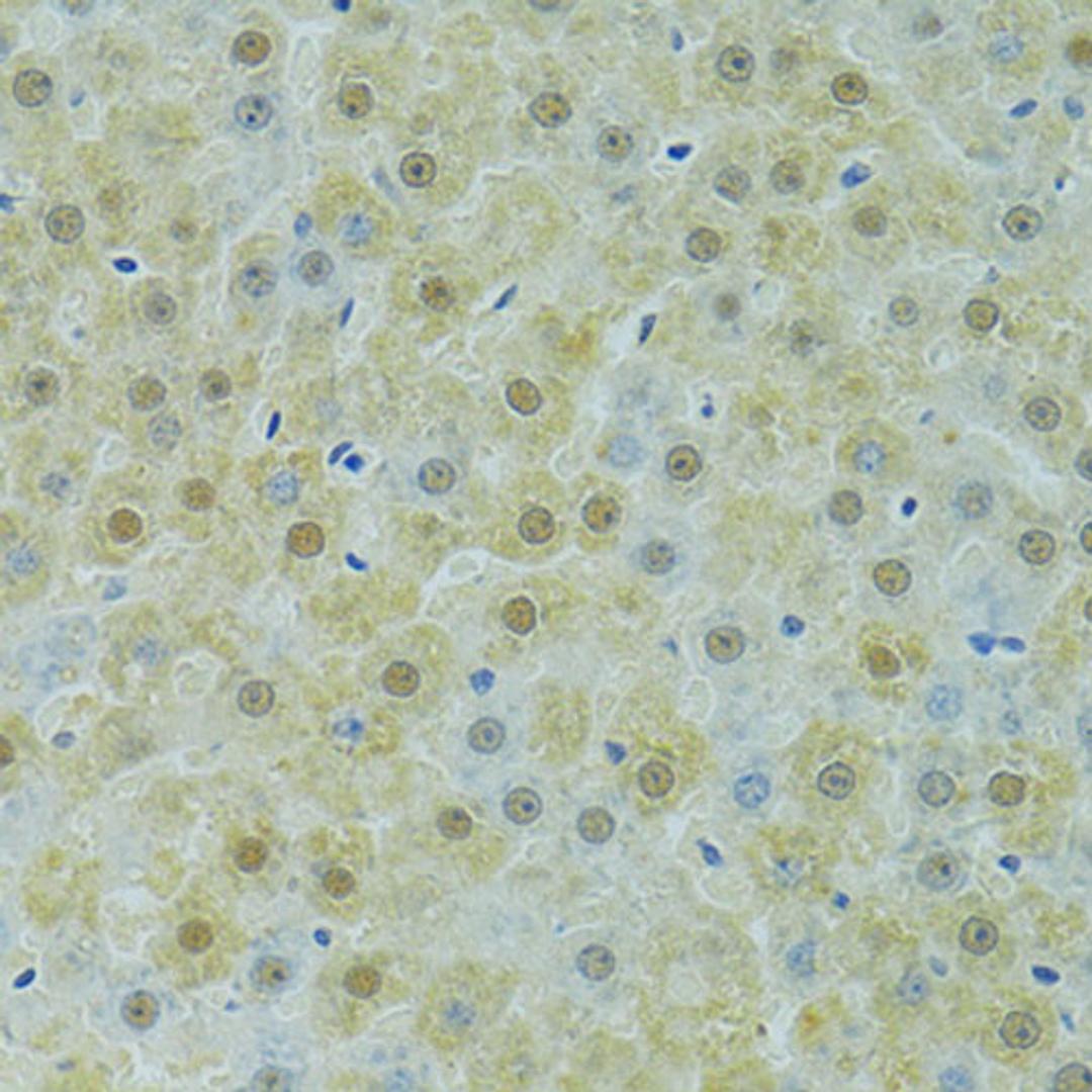 Immunohistochemistry  - SOX14 antibody (A13674)