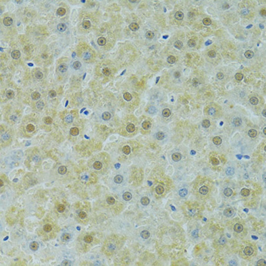 Immunohistochemistry - SOX14 antibody (A13674)