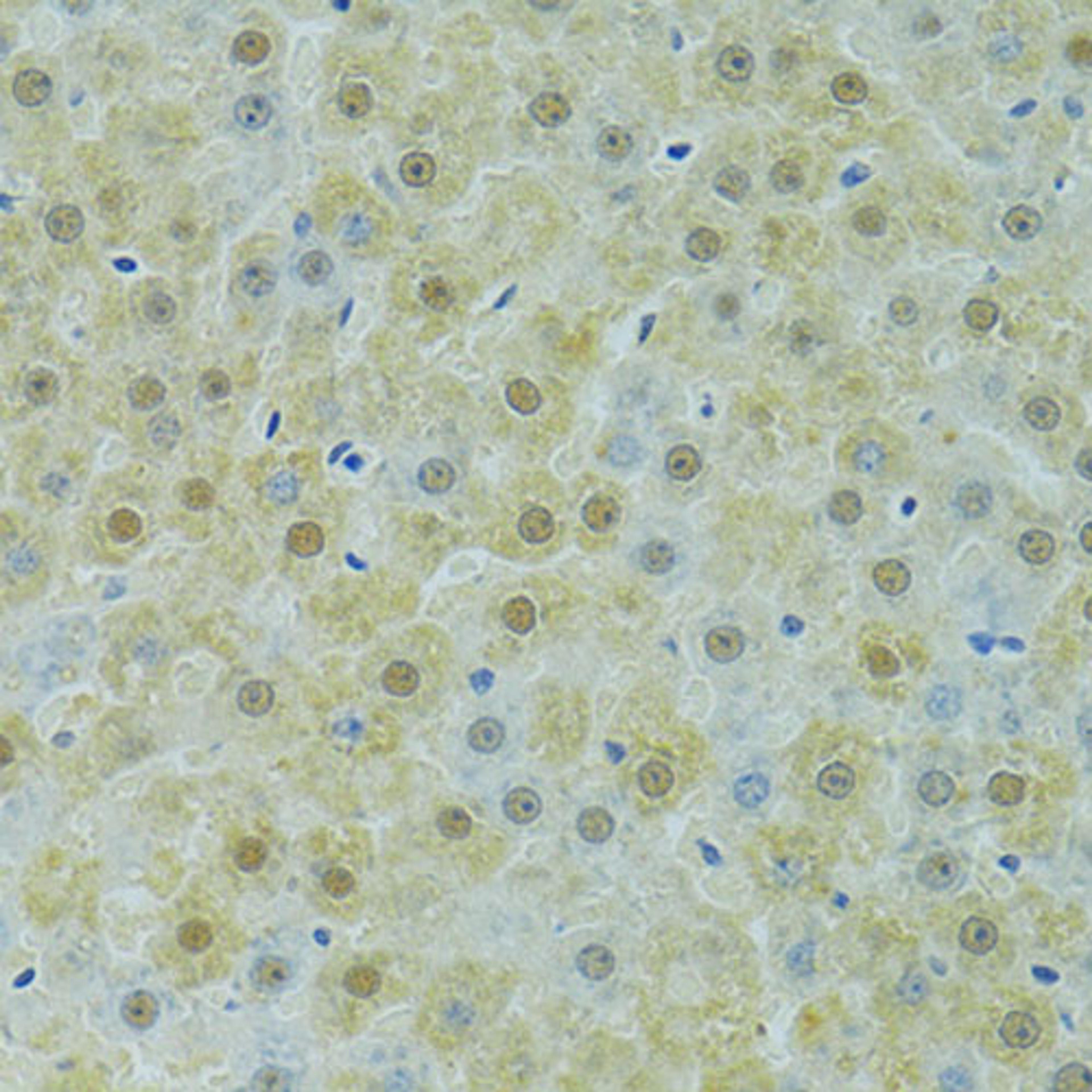 Immunohistochemistry - SOX14 antibody (A13674)