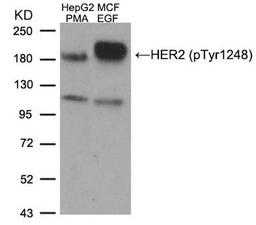 Western blot analysis of extracts from HepG2 cells treated with PMA and MCF cells treated with EGF, using HER2 (Phospho-Tyr1248) Antibody.