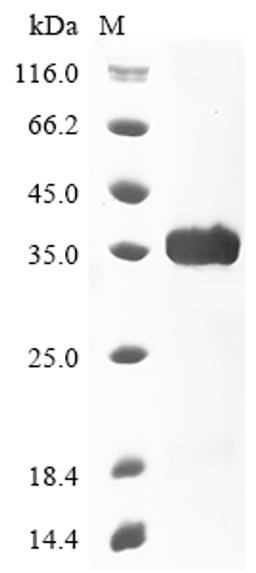 (Tris-Glycine gel) Discontinuous SDS-PAGE (reduced) with 5% enrichment gel and 15% separation gel.