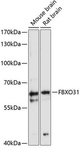 Western blot - FBXO31 antibody (A12888)