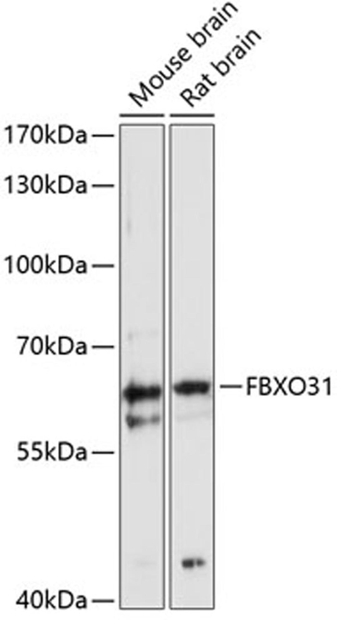 Western blot - FBXO31 antibody (A12888)